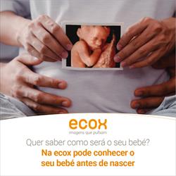 Figueria da Foz prepara-se para receber um novo centro Ecox4D-5D
